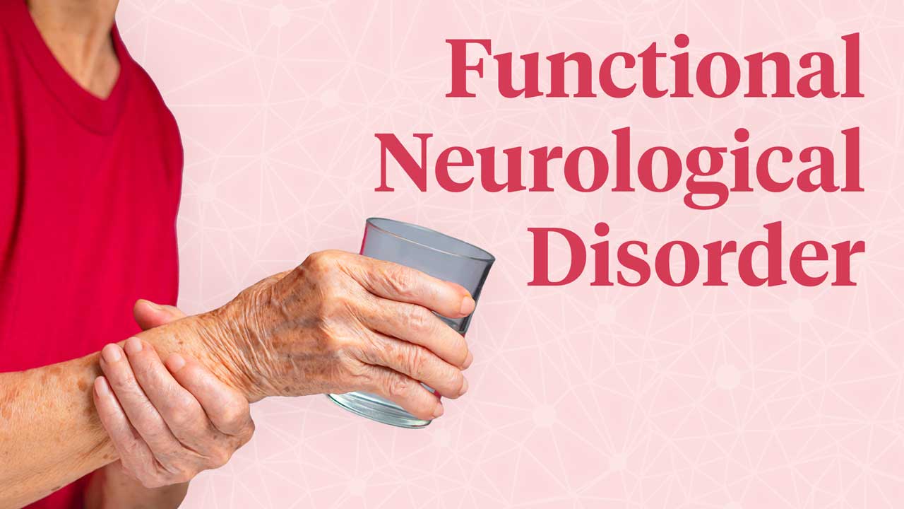 functional-neurological-disorders-case-studies